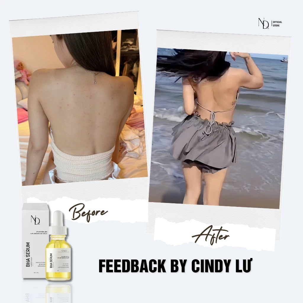 BHA Serum 8%15ml ND giảm mụn Face & Body,giảm viêm nang lông,thu nhỏ lỗ chân lông,tẩy tế bào chết,.. - 4