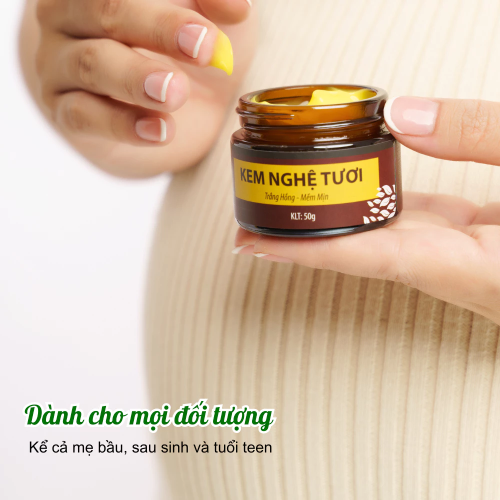 Kem Nghệ Tươi Trắng Da, Ngừa Mụn, Nám, Căng Bóng Da WonMom 50 Gram - 3