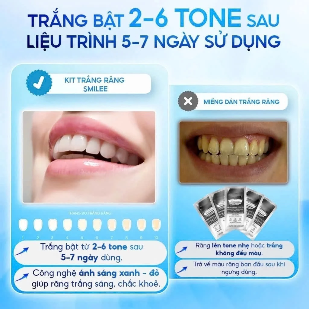 [GIÁ 654K TẠI LIVE SHOP] Trắng răng Smilee Extra, bộ kit làm trắng răng từ 2-6 tone sau một liệu trình. Hàng chính hã - 3