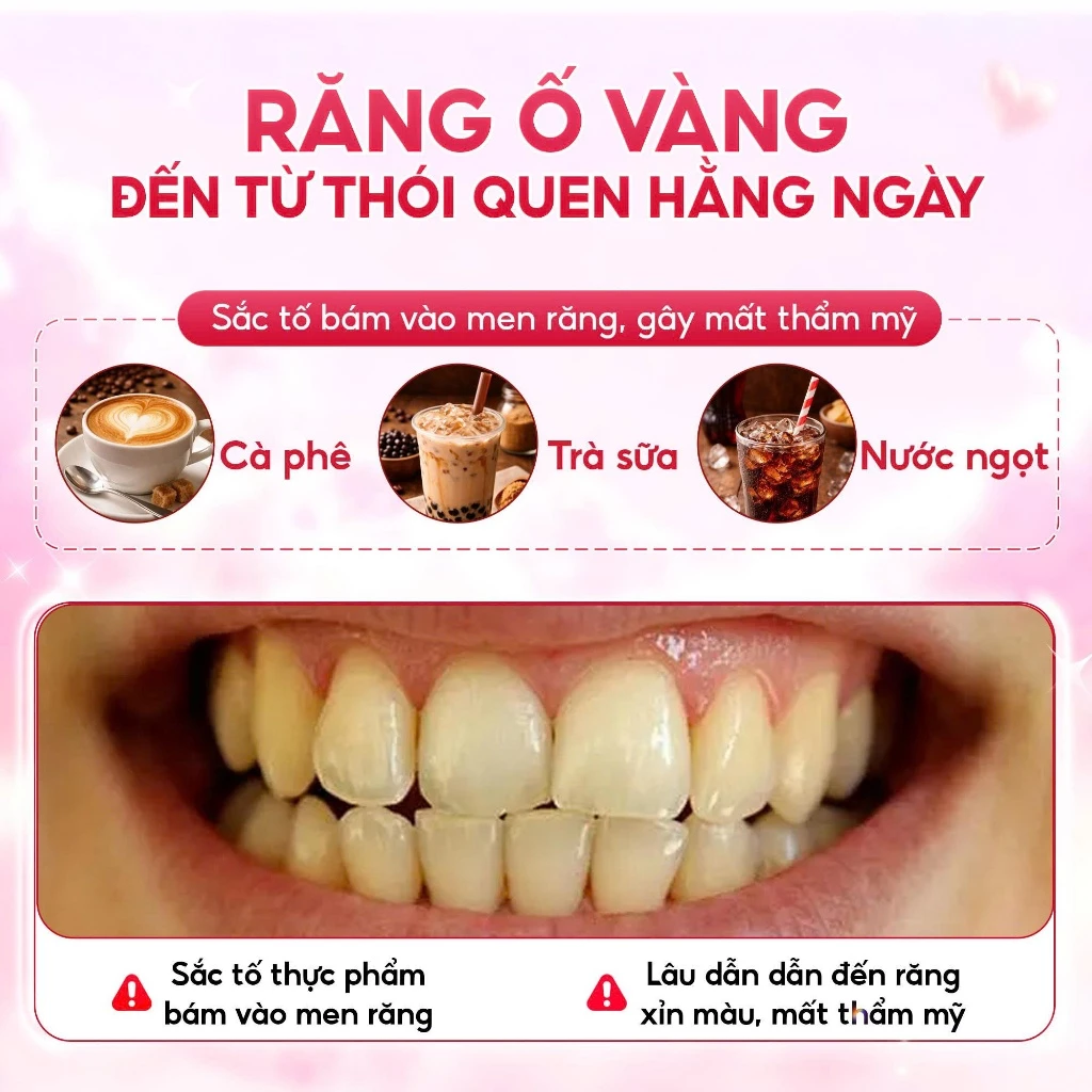 [GIÁ 638K LIVE ECOGO] Bộ Kit Trắng Răng Smilee Extra, Làm Trắng Răng Bật 2-6 Tone Tại Nhà Phiên Bản Nâng Cấp - 2