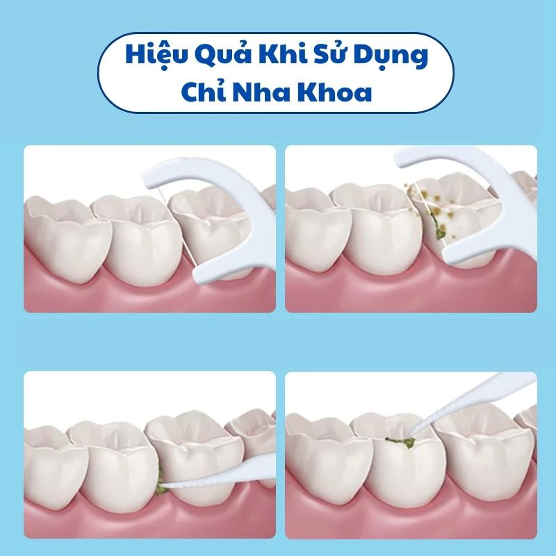 Tăm Chỉ Nha Khoa Nhật Bản Tấm Thị Chính Hãng Hộp 50 Chiếc Loại Bỏ Sạch Mảng Bám Thức Ăn Ngăn Ngừa Hôi Miệng Sâu Răng - 4