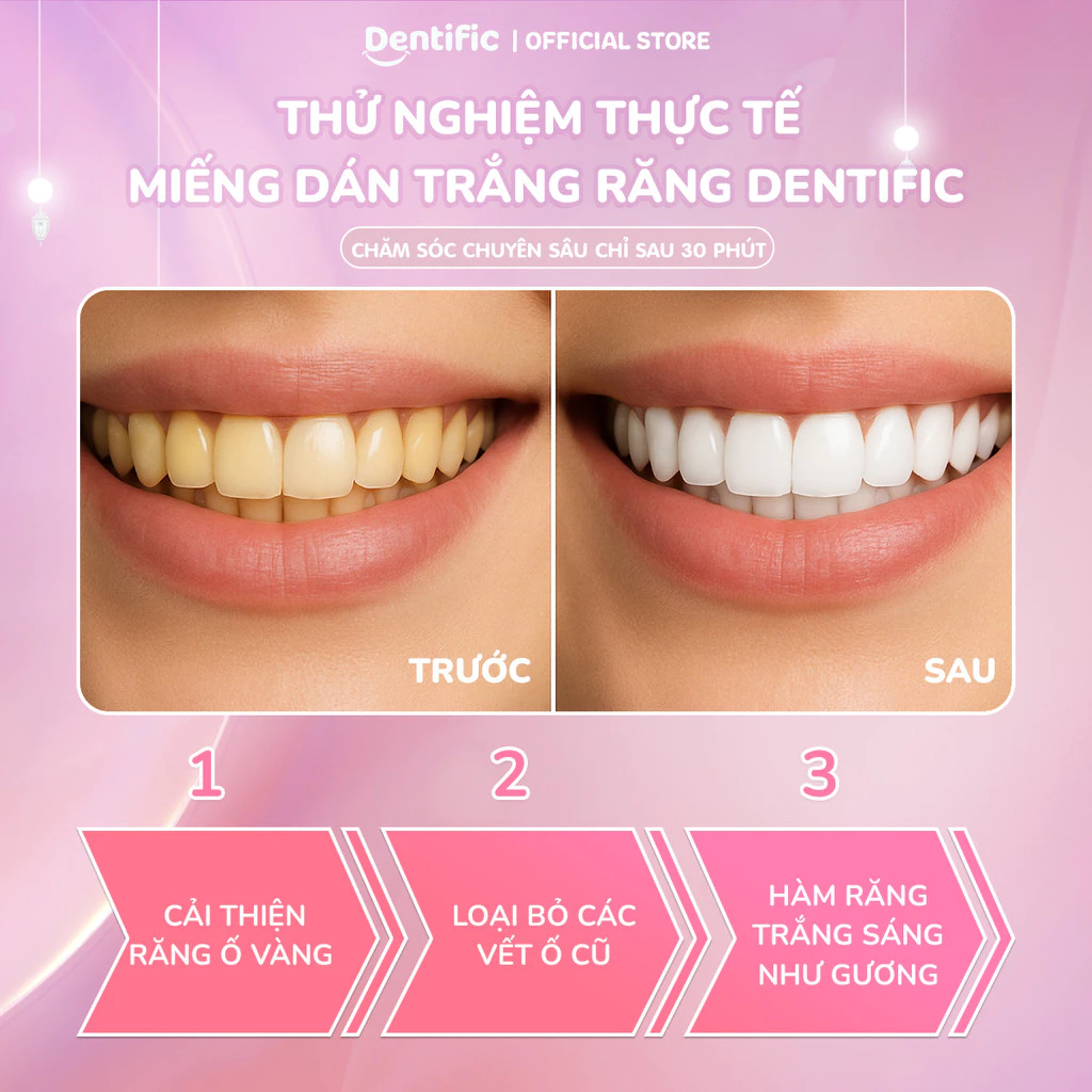 Miếng dán trắng răng Dentific sạch mảng bám, hỗ trợ cải thiện ố vàng răng miệng, hộp 5 miếng trắng răng - 2