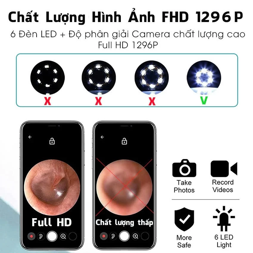 Dụng Cụ Lấy Ráy Tai Có Gắn Camera Nội Soi Full HD Đa Năng - Kết Nối Điện Thoại - Bảo Hành 12 Tháng - 3