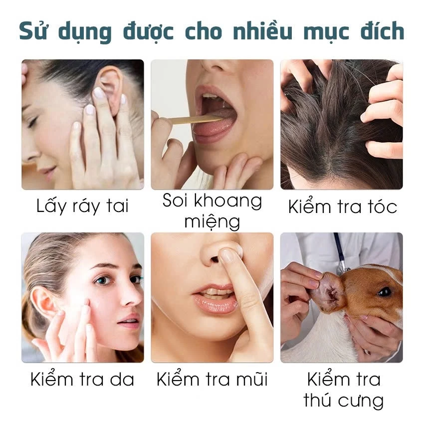 Dụng Cụ Lấy Ráy Tai Có Gắn Camera Nội Soi Full HD Đa Năng - Kết Nối Điện Thoại - Bảo Hành 12 Tháng - 5