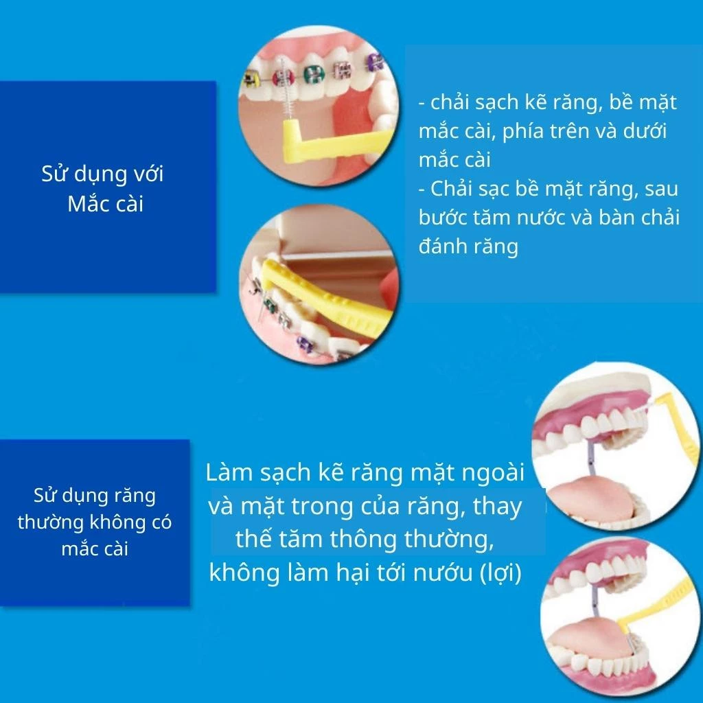 Set 10 bàn chải kẽ vệ sinh răng niềng Korona, tăm nha khoa bàn chải kẽ răng vệ sinh răng miệng chữ L - 4