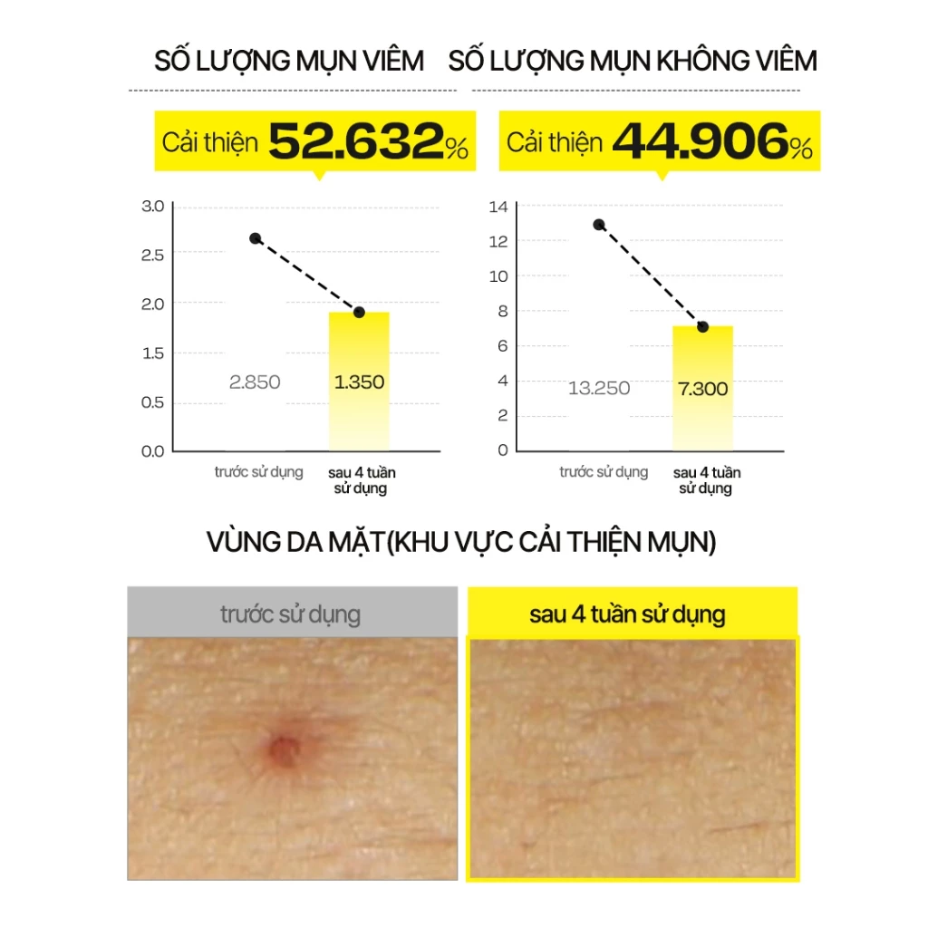 [d'Alba Official] Serum dạng xịt khoáng căng bóng da First Spray Serum 50ml/100ml - Mist Serum - 6