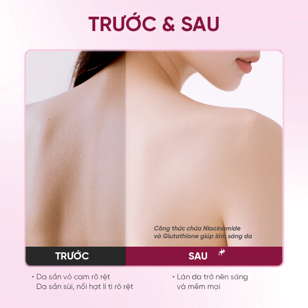 Sữa tắm trắng da hỗ trợ dưỡng ẩm tẩy da chết Grace and Glow nước hoa Body Wash 400ml Niacinamide lưu hương lâu thơm - 3