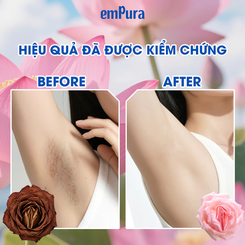 Combo Sáng Hồng Ẩm Mượt Vùng Kín EmPura Serum Dưỡng Ẩm Mờ Thâm, Kem Dưỡng Ẩm Sáng Da EmPura - 4