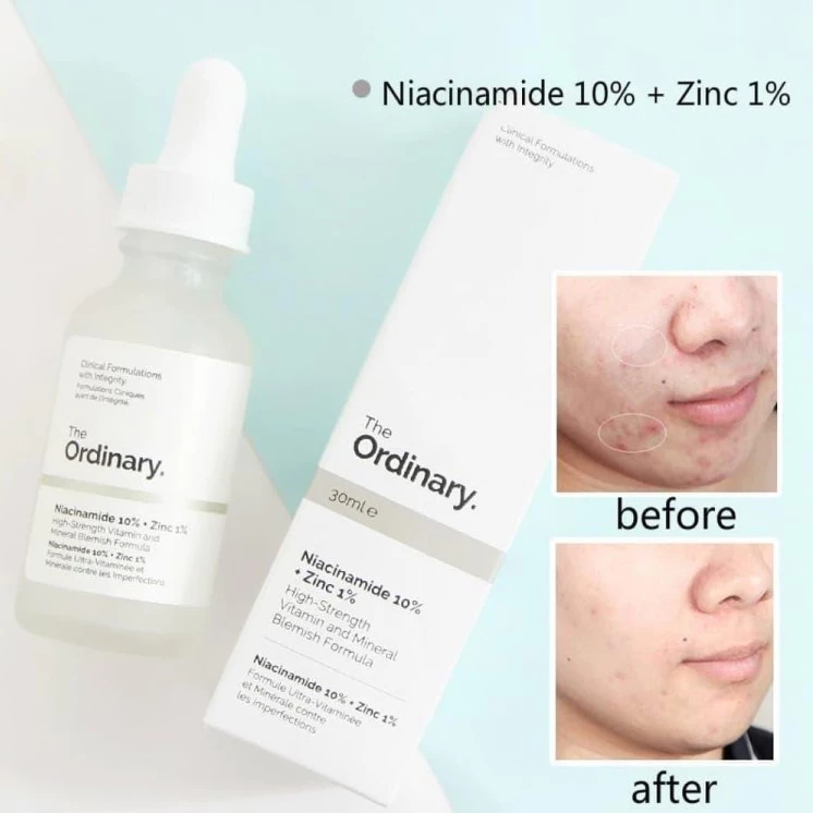Tinh chất The Ordinary Niacinamide 10% + Zinc 1% Vs The Ordinary AHA 30% + BHA 2% 30ml - 2