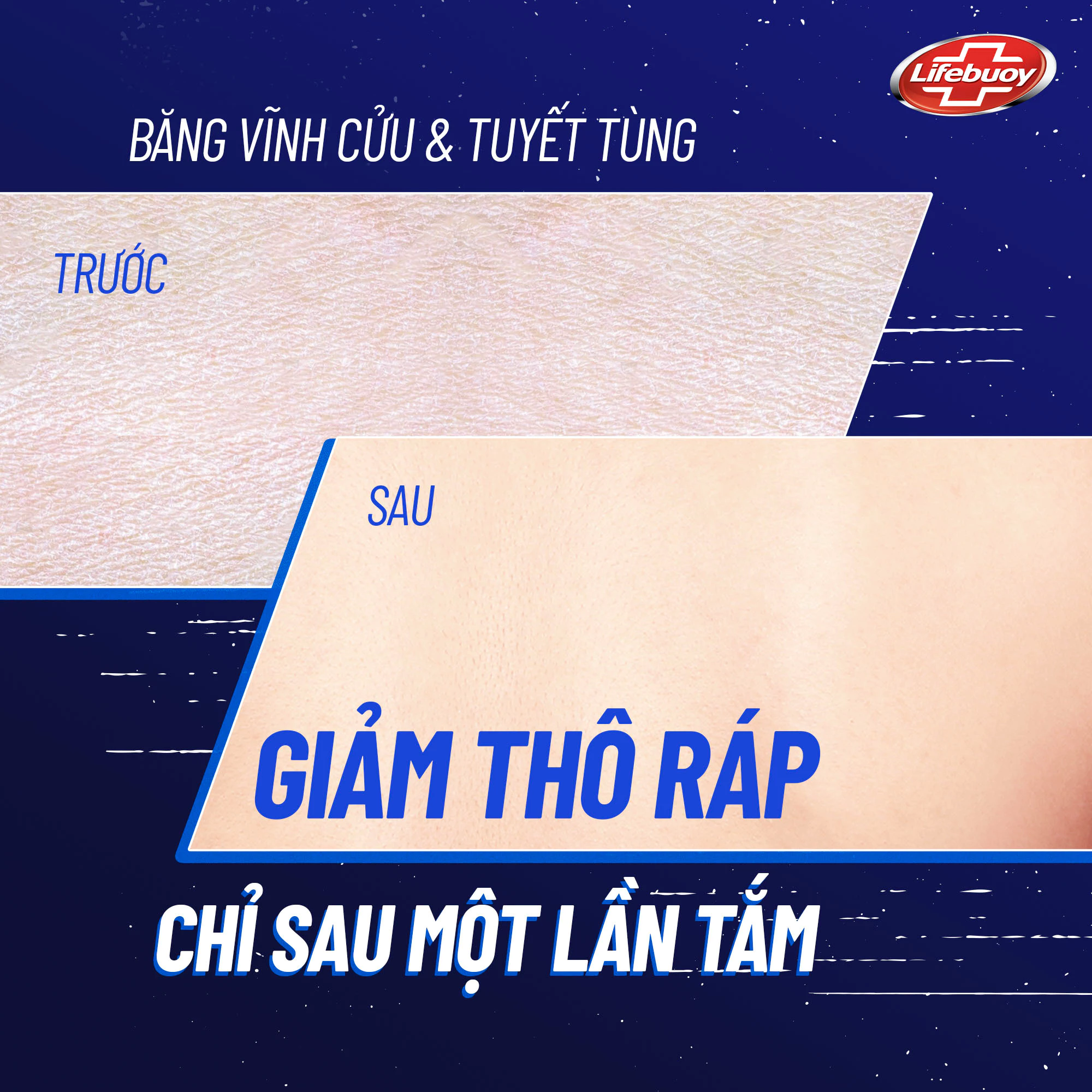 Sữa Tắm Lifebuoy 800gr Detox Và Sạch Sâu Khỏi Bụi Mịn Pm2.5 Detox 100% Từ Thiên Nhiên Diệt Khuẩn - 6