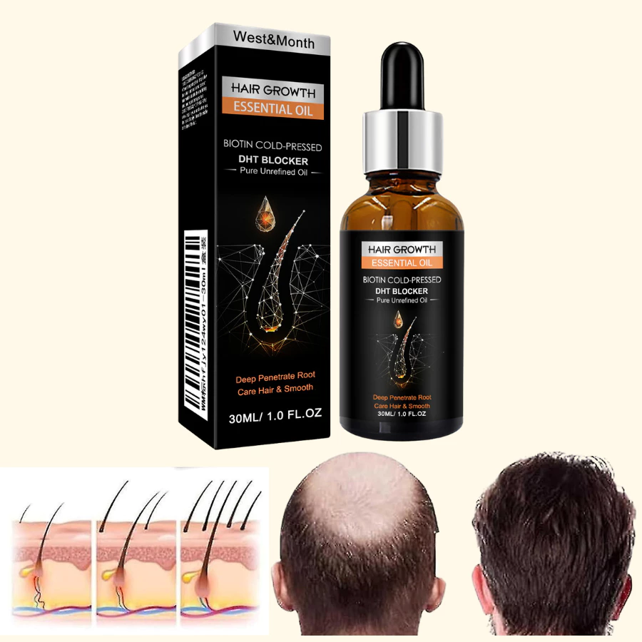 Serum Tinh Chất Mọc Tóc Giảm Gàu , Thảo Dược Kích Thích Mọc Tóc Giảm Nấm Ngứa, Giúp Tóc Chắc Và Khoẻ - 2