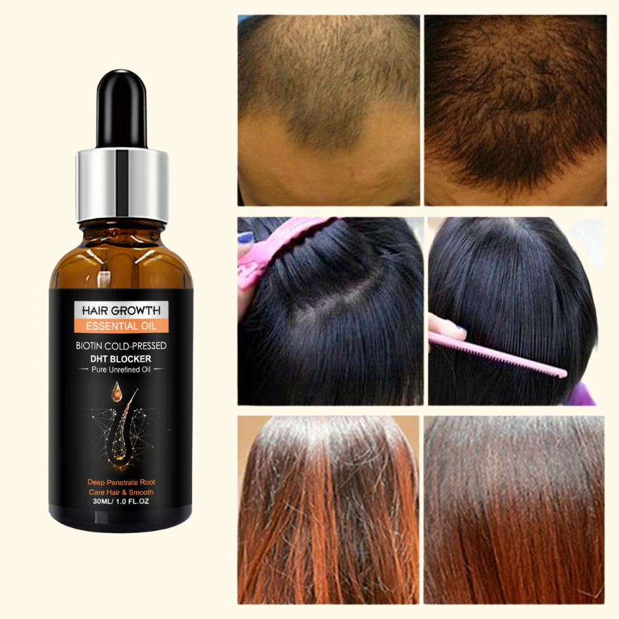 Serum Tinh Chất Mọc Tóc Giảm Gàu , Thảo Dược Kích Thích Mọc Tóc Giảm Nấm Ngứa, Giúp Tóc Chắc Và Khoẻ - 6