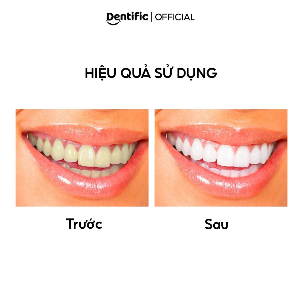 Kem đánh răng Dentific Hỗ trợ làm trắng và làm sạch răng miệng 100g trắng răng - 6