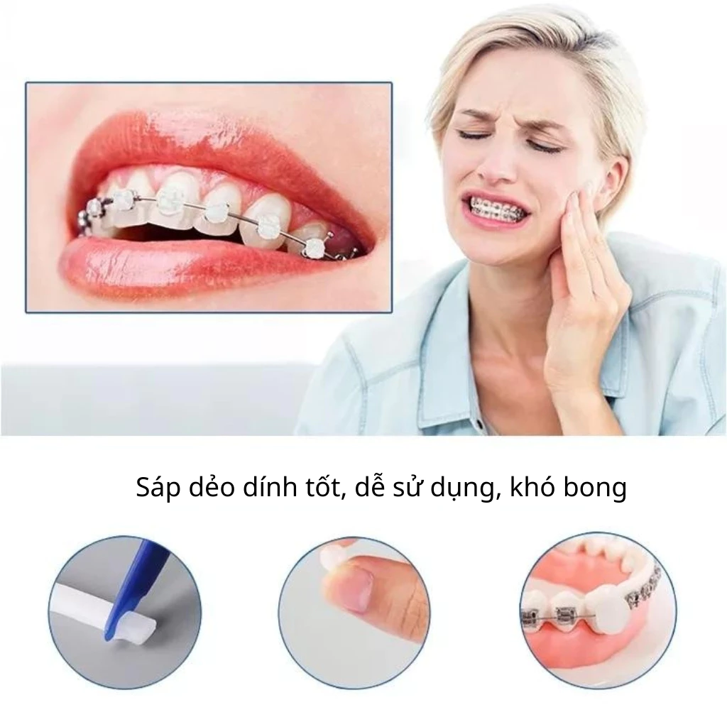 Sáp nha khoa niềng răng (chọn mùi), sáp chỉnh nha 5 thanh, sáp bôi niềng răng giảm đau loại tốt - Dinh Dinh - 2
