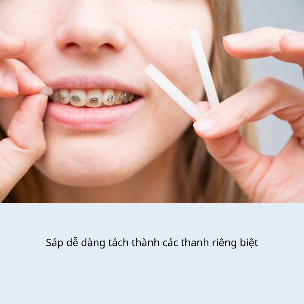 Sáp nha khoa niềng răng (chọn mùi), sáp chỉnh nha 5 thanh, sáp bôi niềng răng giảm đau loại tốt - Dinh Dinh - 3