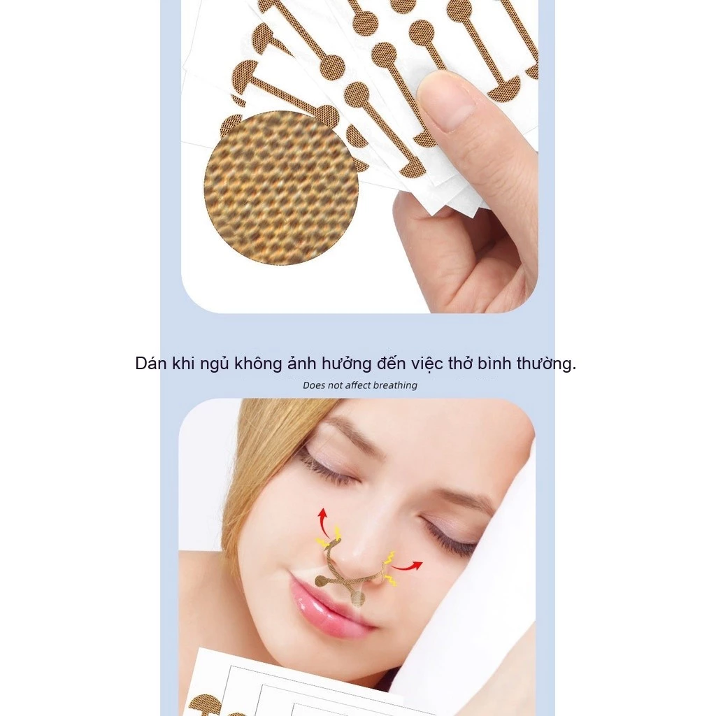 Băng co mũi hẹp, thần kỳ ngủ, dạng ẩn, co giãn cơ, thẩm mỹ, ngăn mũi tán ra, chỉnh sửa mũi - 6
