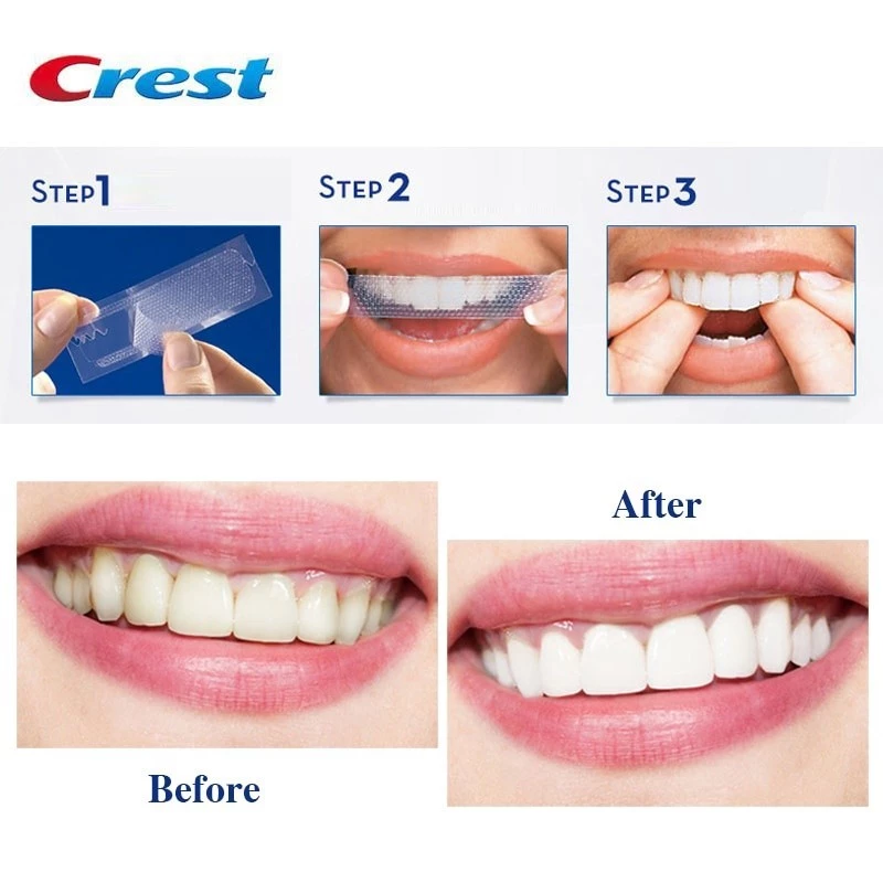 CREST Miếng Dán Trắng Răng 3D An Toàn Vệ Sinh Răng Miệng Dải Trắng Răng Crest 3D Chuyên Nghiệp - 4